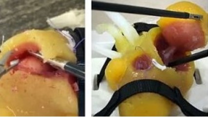 Urotrainer Hands-On:Nefrectomía Parcial Laparoscópica